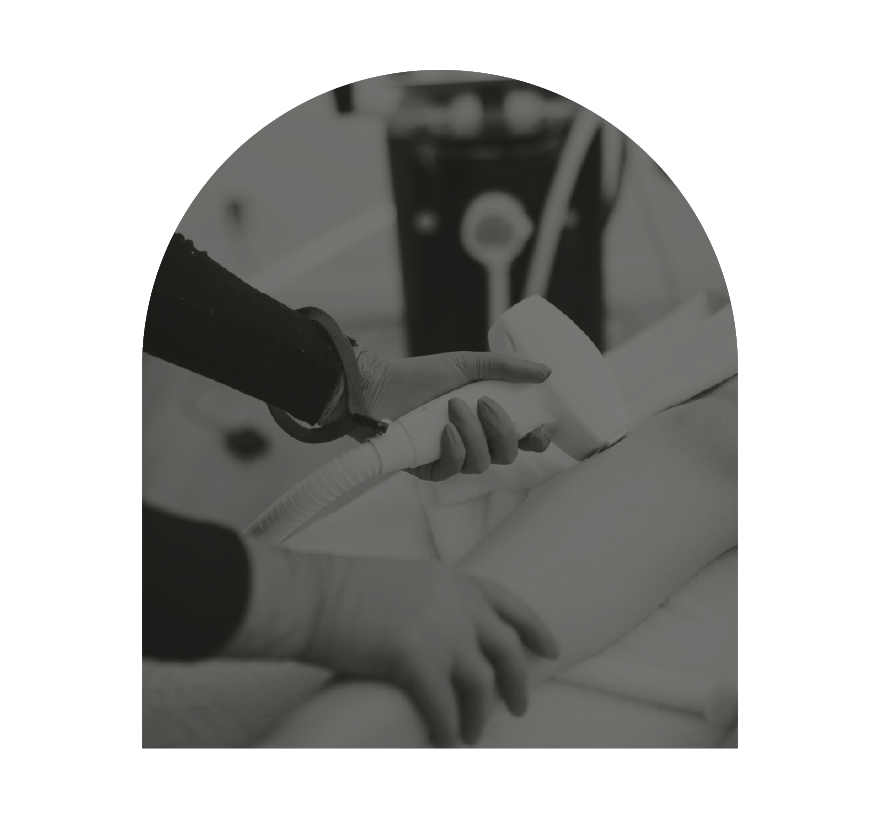 innovaderm-esthetique-_epilation