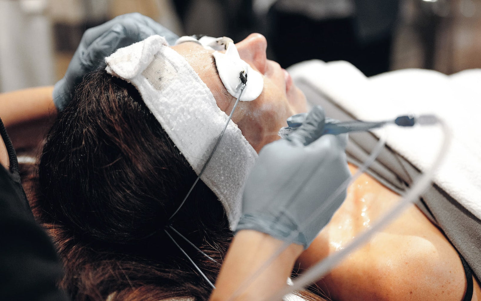 innovaderm-esthetique-jet-peel