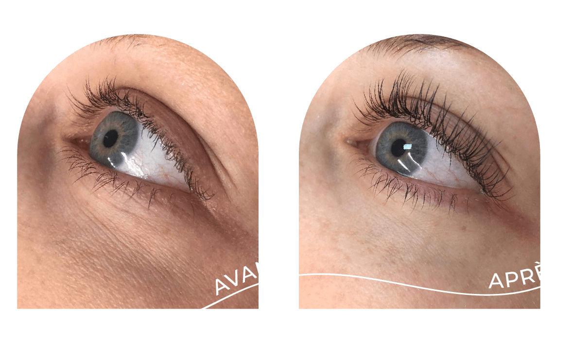 innovaderm-esthetique-lash-lift