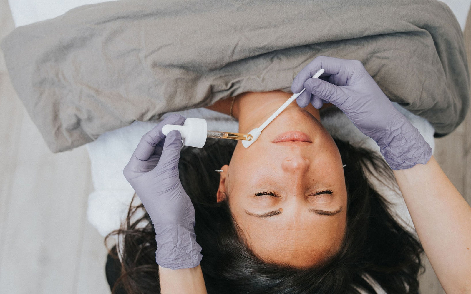 innovaderm-esthetique-peeling