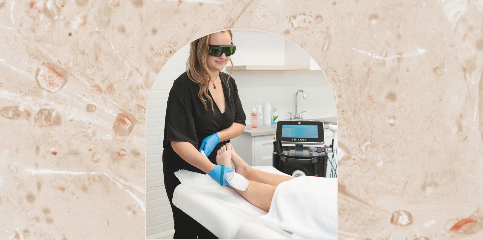 Est-ce qu'on peut faire de l’épilation laser en été ?