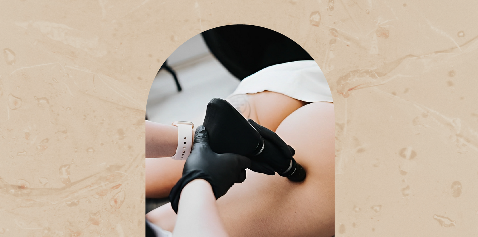 se-débarasser-de-la-cellulite