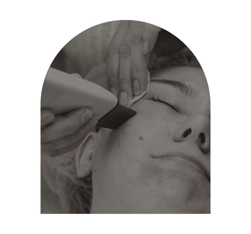 innovaderm-esthetique_acne-peeling