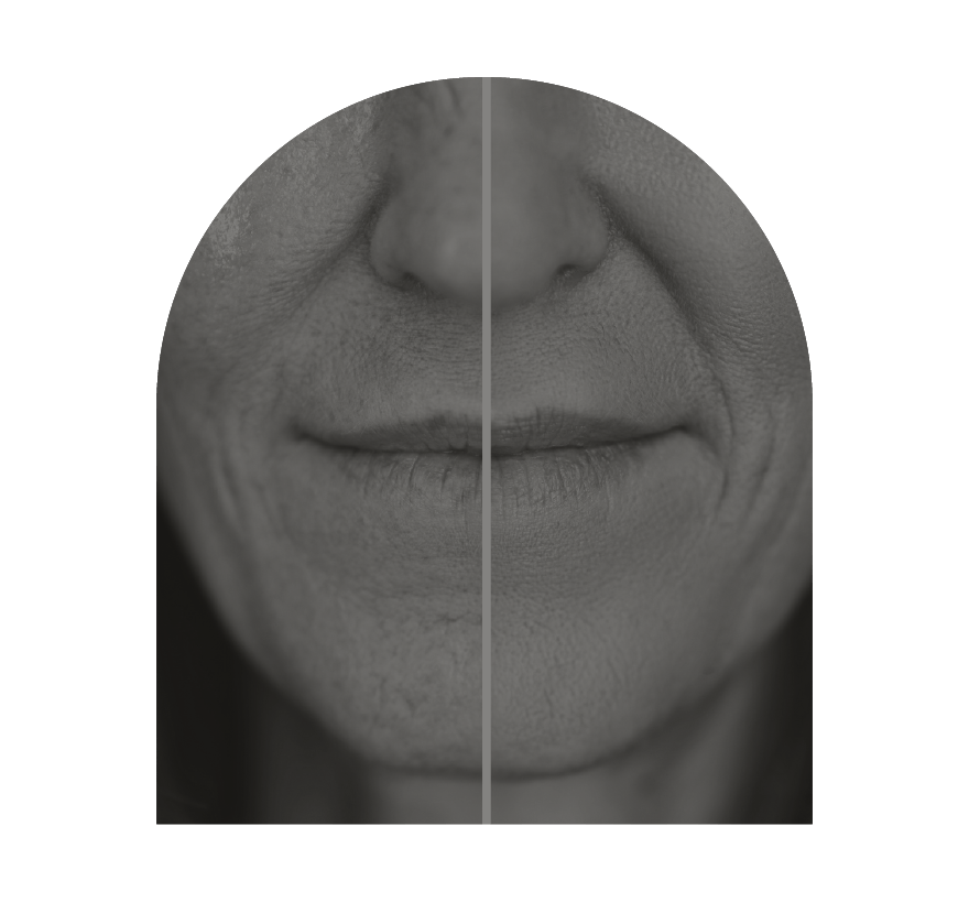 innovaderm-esthetique_amelioration-peau-rajeunir