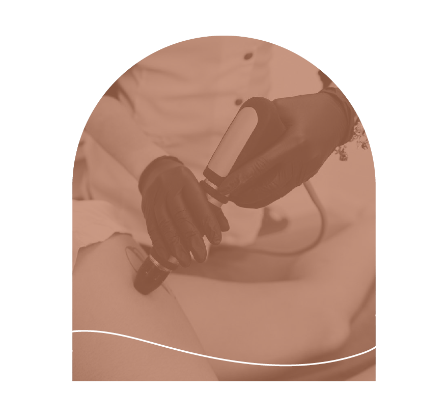 innovaderm-esthetique_cellulite-traitement