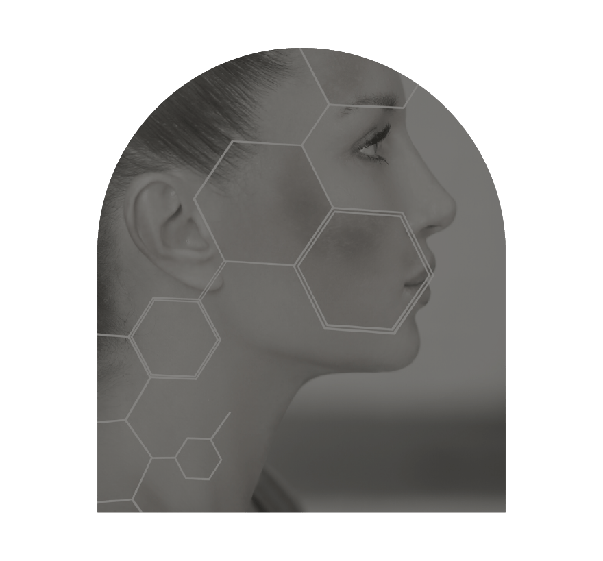 innovaderm-esthetique_correction-teint-rougeurs