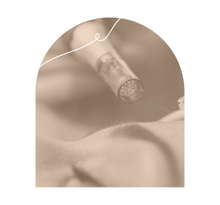 innovaderm-esthetique_microneedling-rajeunissement-peau